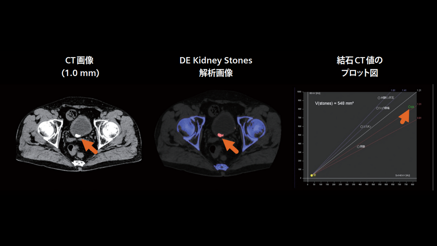 JP-CT-Pro.Pulse_CaseRport_vol.3-1