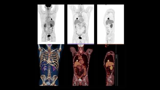 The right PET/CT for a diverse portfolio - Siemens Healthineers