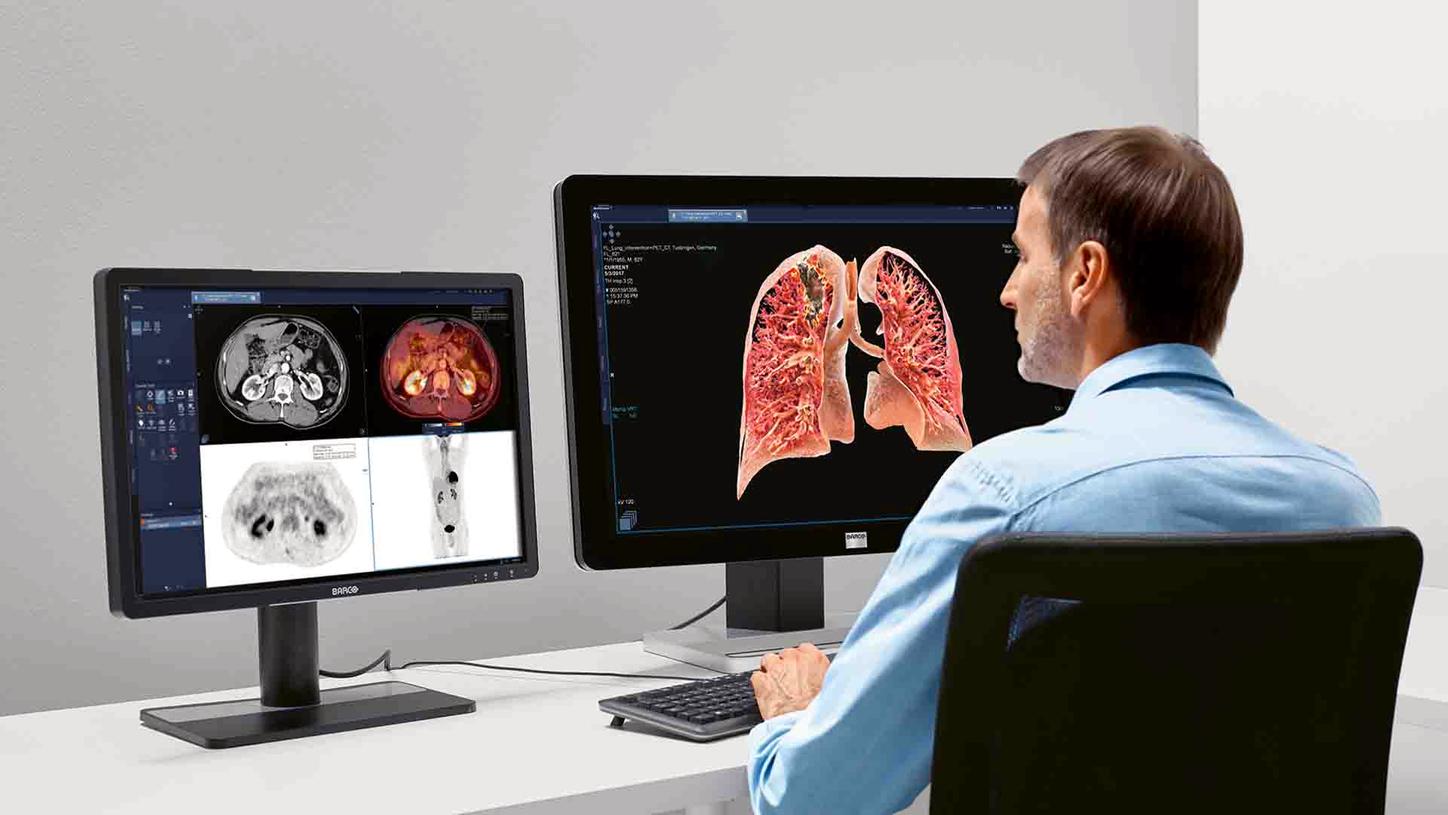 syngo.via – Intensive