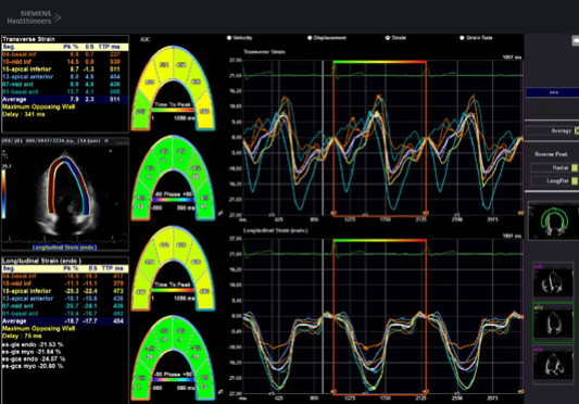 EC Findings - Management & Impression