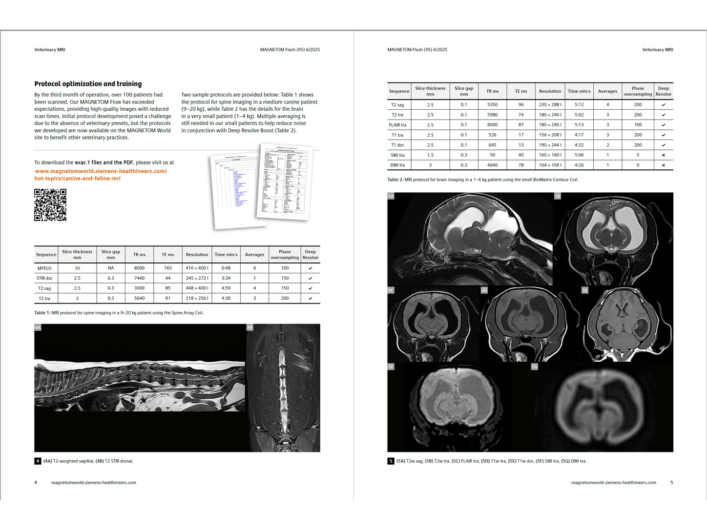 Siemens-healthineers_magnetomworld_wilson_flow43.