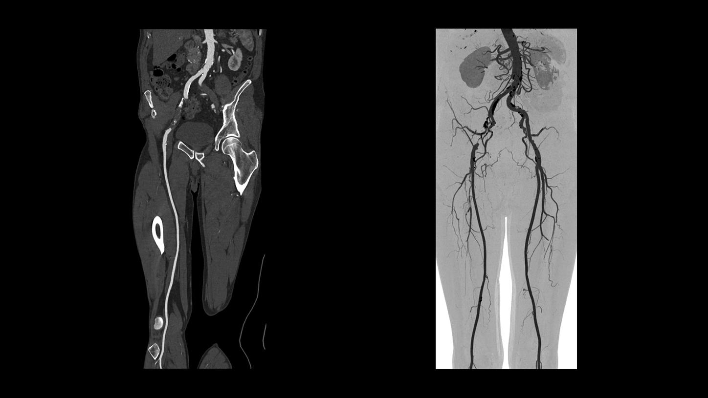 SOMATOM Edge Plus - Clinical Image