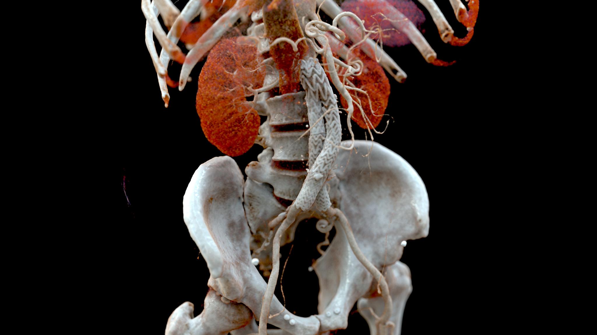 Cinematic Rendering in medical imaging - Siemens Healthineers