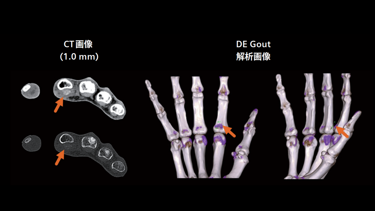 JP-CT-Pro.Pulse_CaseRport_vol.3-2