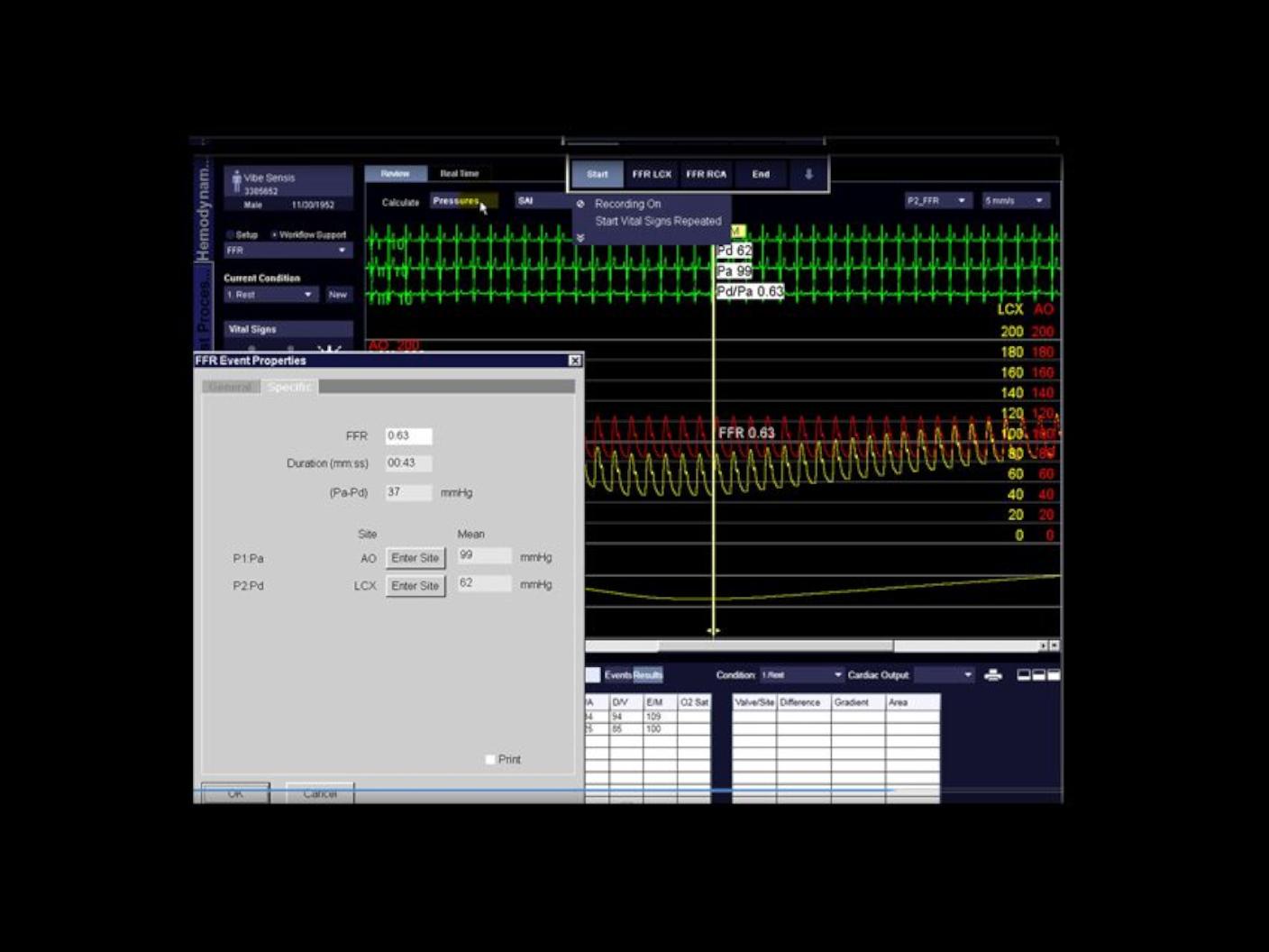 Gold standard: wire-based FFR and non-hyperemic pressure ratios