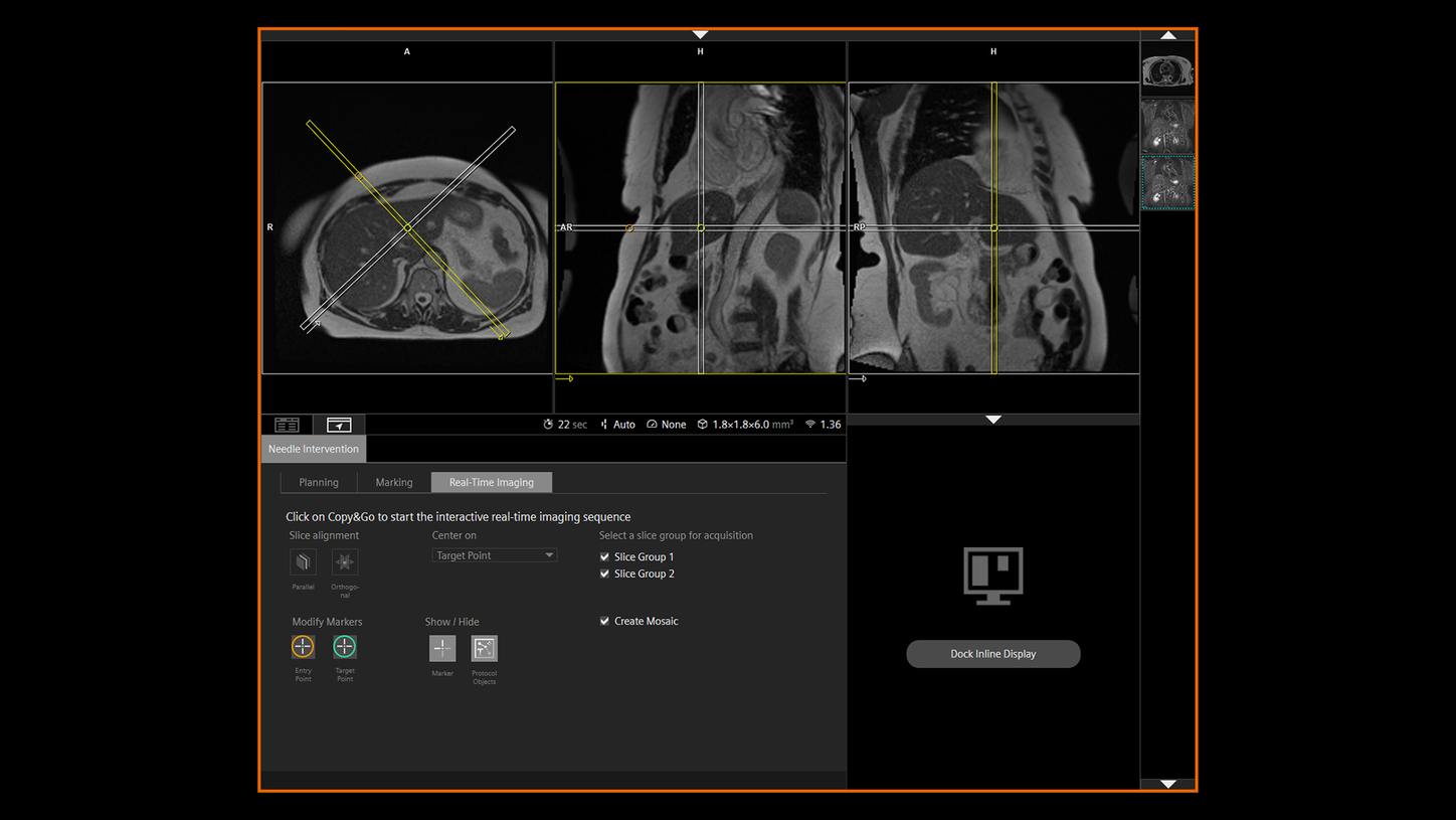 Streamlined planning for precise targeting