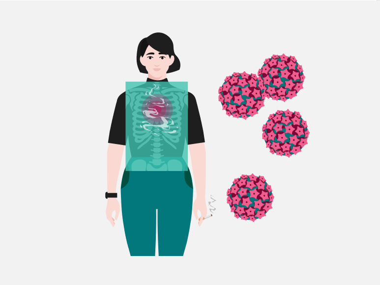 Head and neck cancer smoking