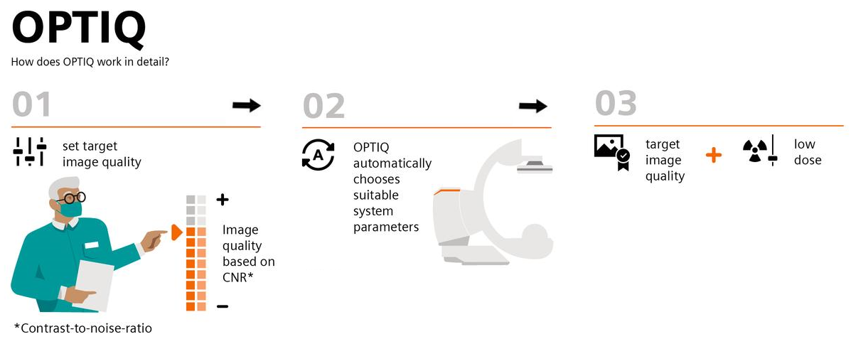 OPTIQ - how does OPTIQ work in detail