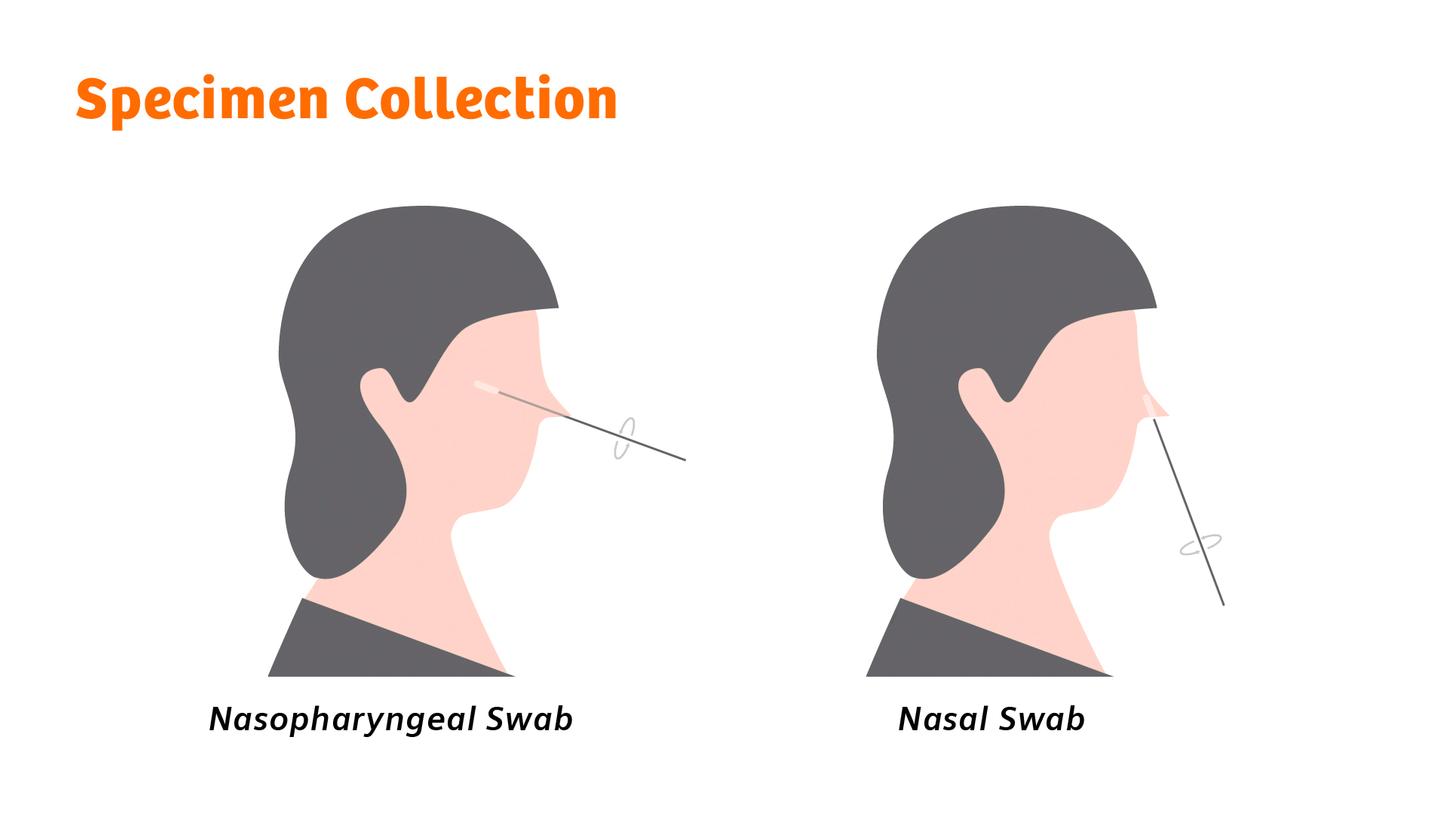 Illustration of the steps involved in rapid testing, beginning with nasopharyngeal sample collection, and ending with dropping sample into cassette well