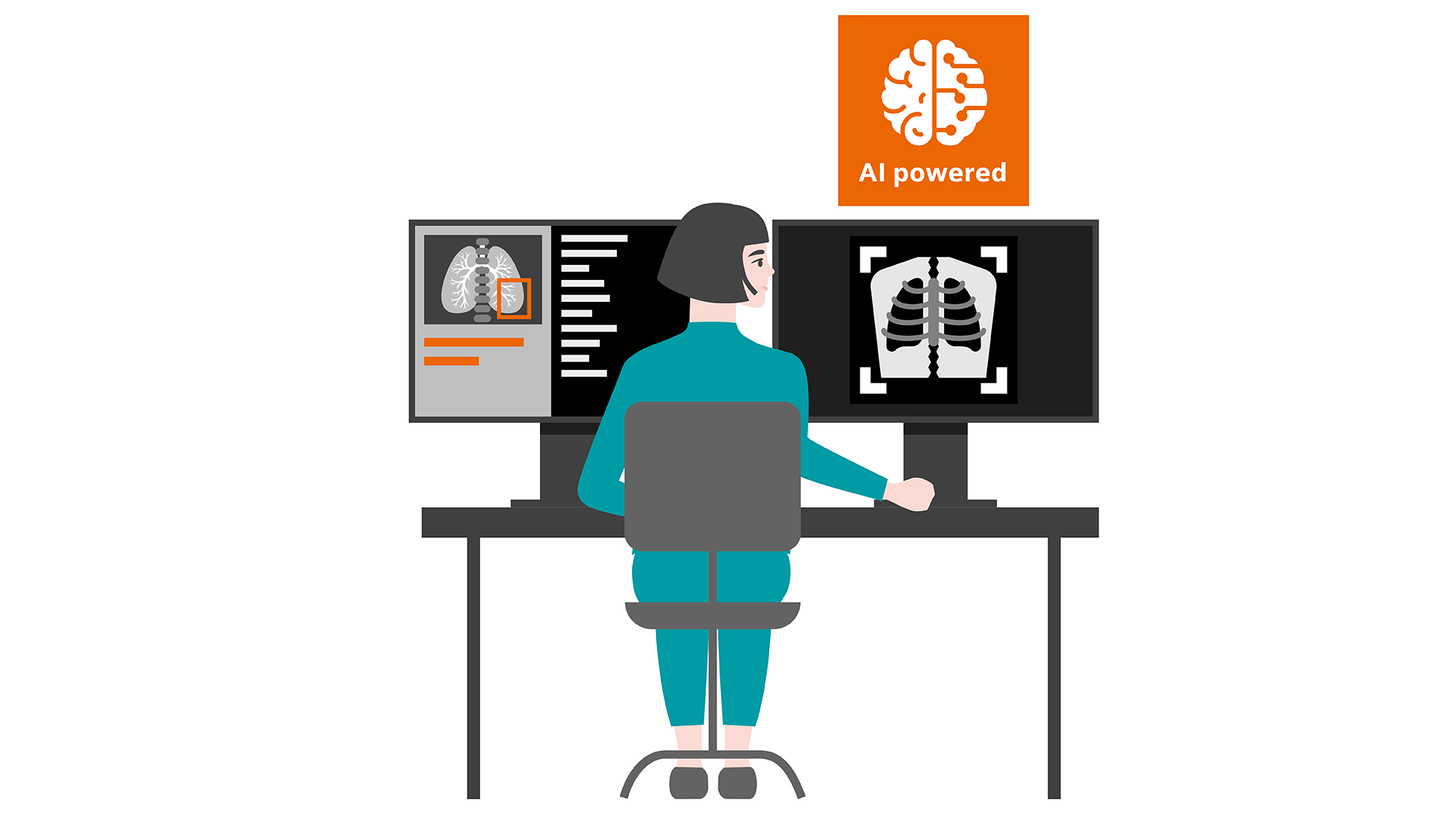 AI reporting support in lung cancer care