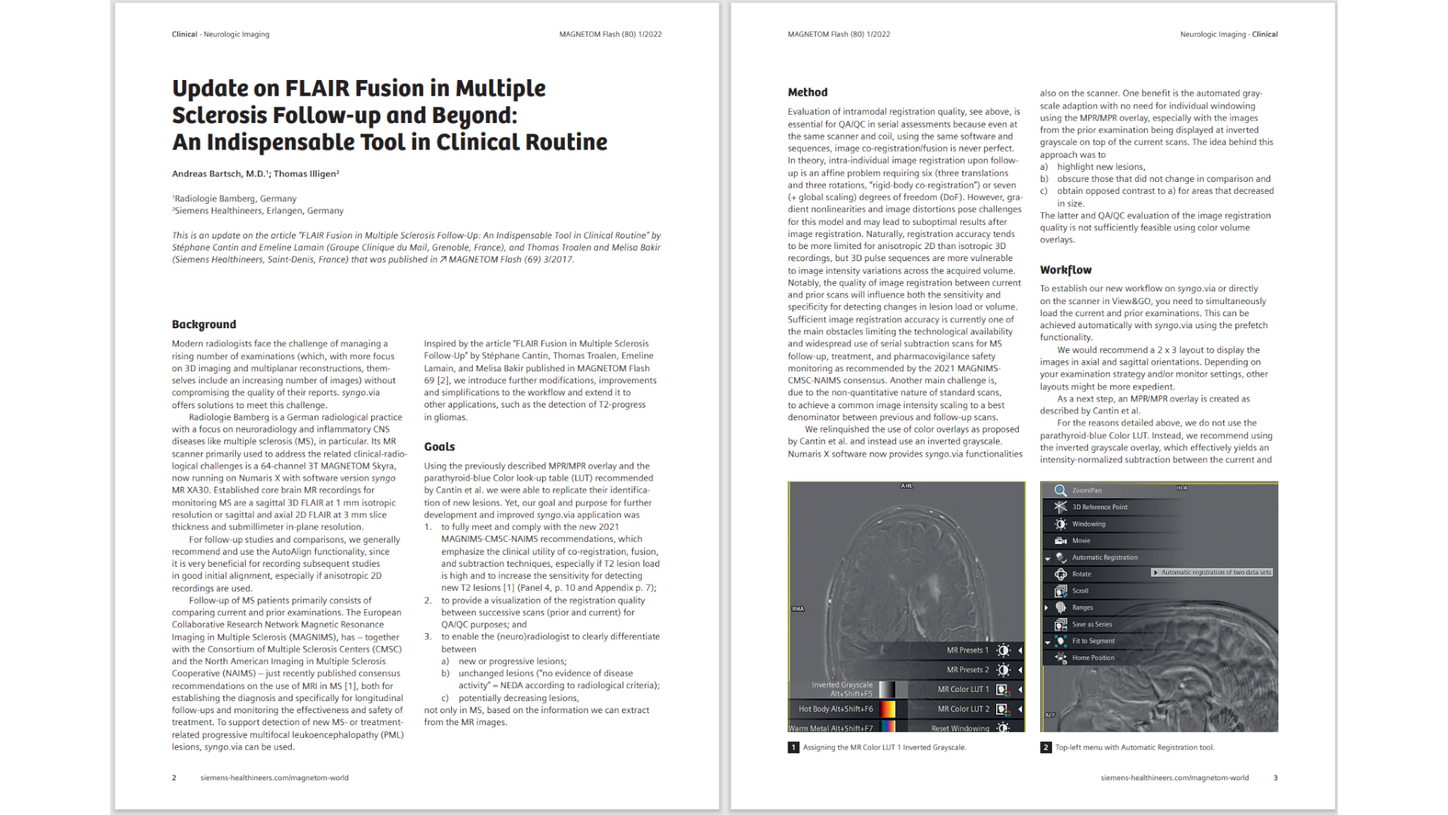 siemens-healthineers_Magnetomworld_Update-FLAIR-Fusion