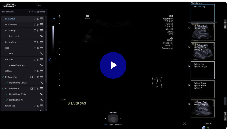 Ultrasound Machines - Siemens Healthineers Singapore
