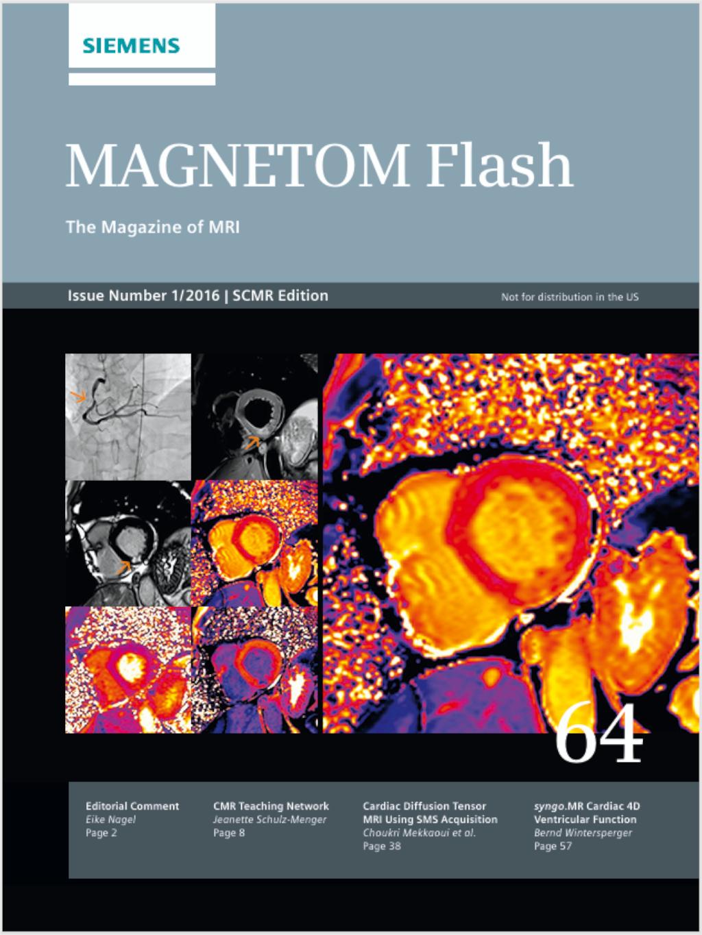 magnetom-flash_64_2016