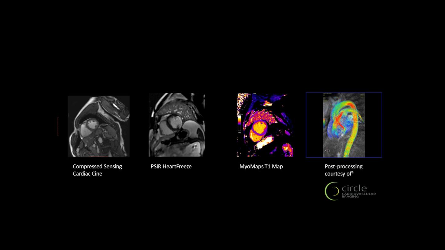 Advanced Cardiac in action 