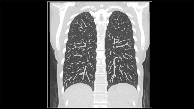 Naeotom Alpha klinisches Bild