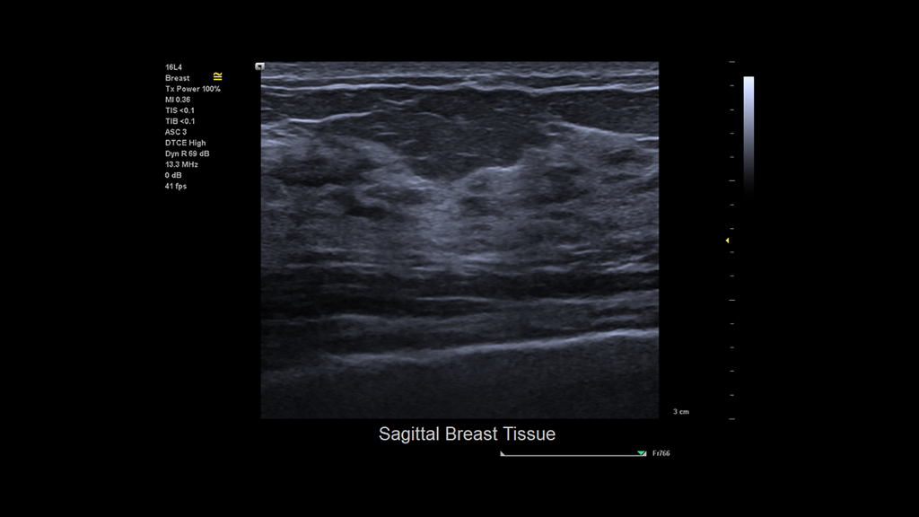 ACUSON Juniper Ultrasound System Siemens Healthineers USA