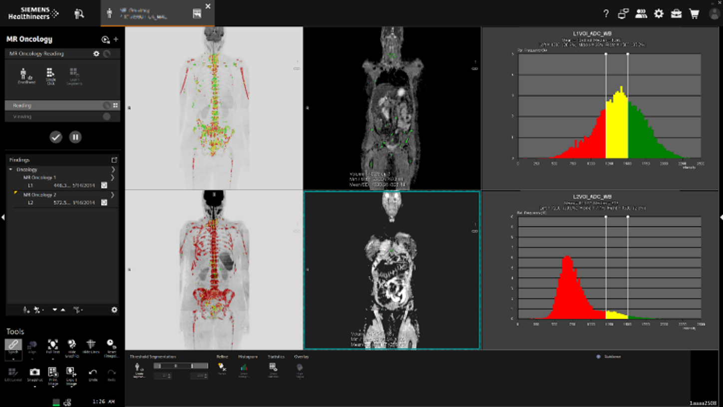 Treatment delivery and adaptation