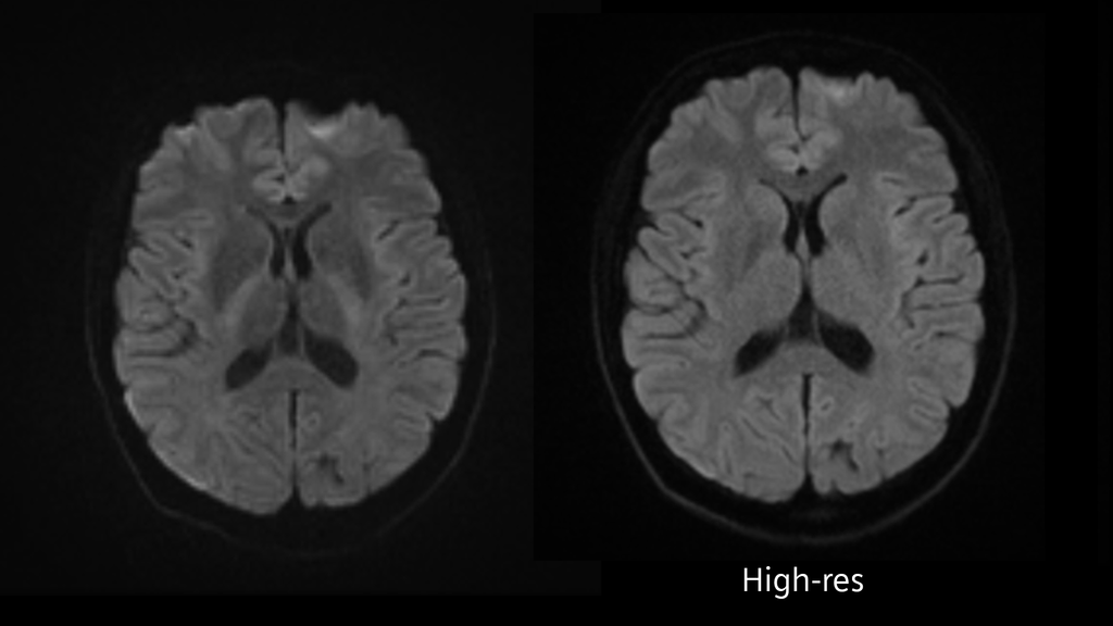 Proisma Scan MAGNETOM Prisma - MRI Scanner - Siemens Healthineers