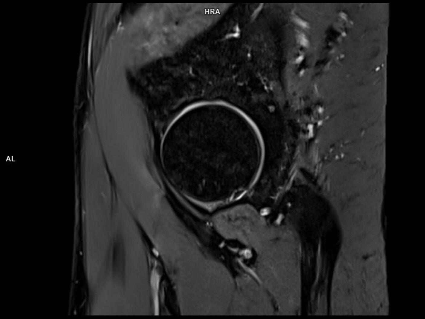 Sagittal PD FS-MAGNETOM Lumina