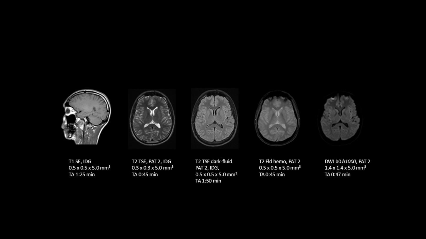 Brain using ID Gain form MAGNETOM Sempra