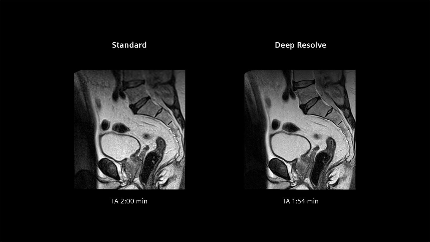 Clinical image Deep Resolve