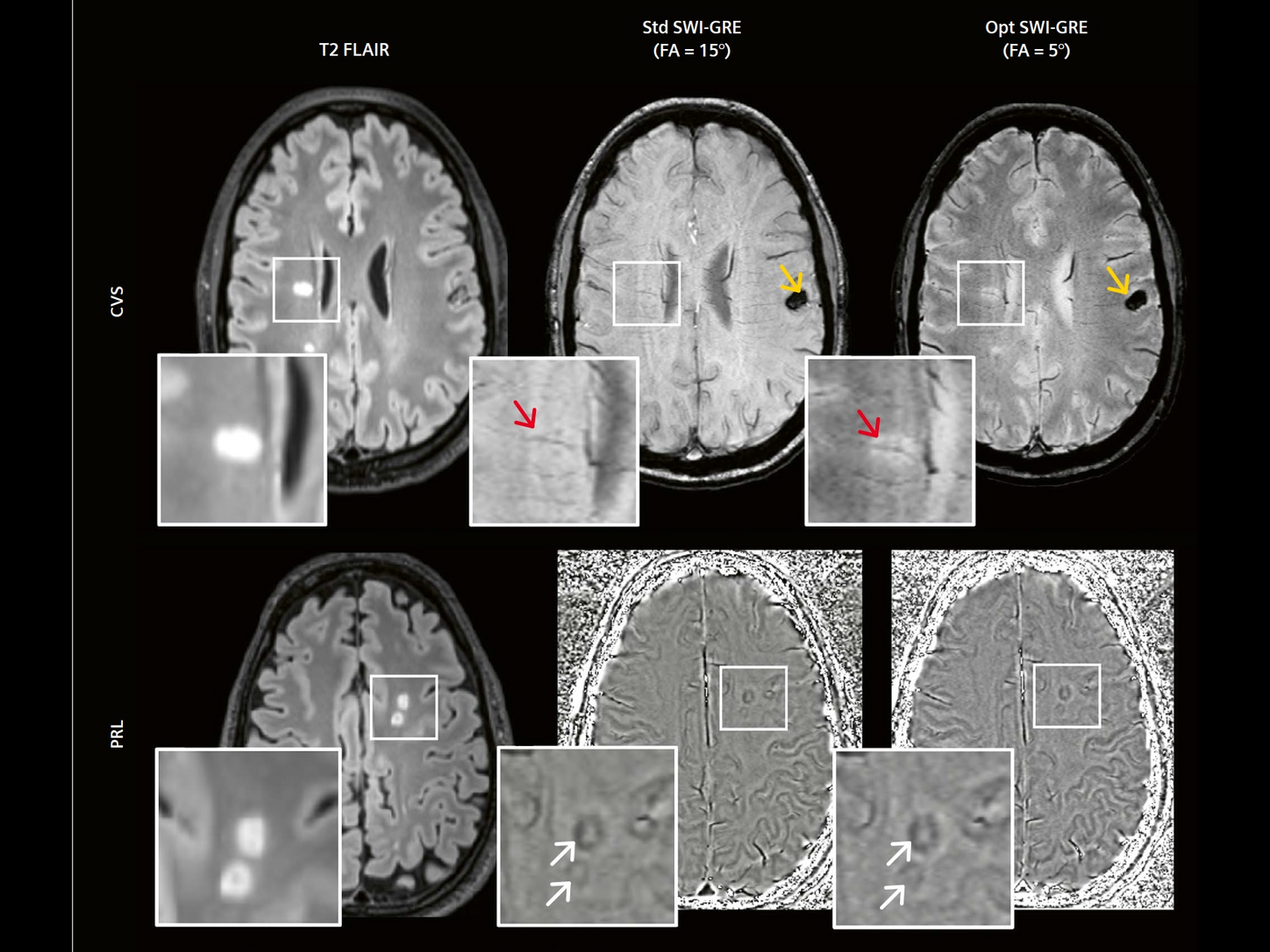 Siemens-healthineers_Magnetomworld_ms-portlet