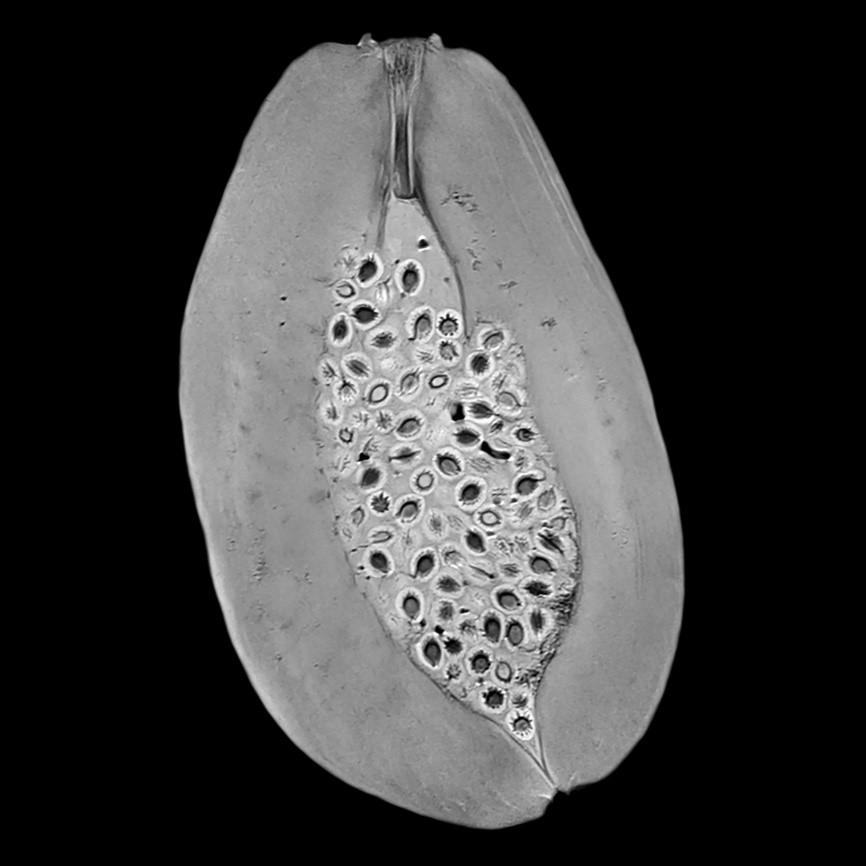 Siemens-healthineers_Magnetomworld_Papaya_CimaX