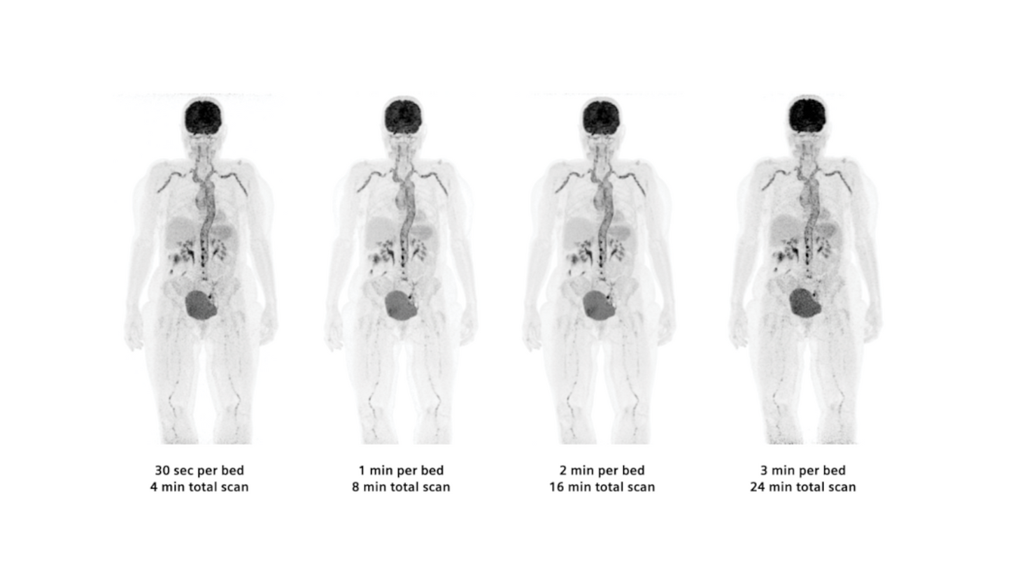 Biograph Vision clinical image gallery - image 1