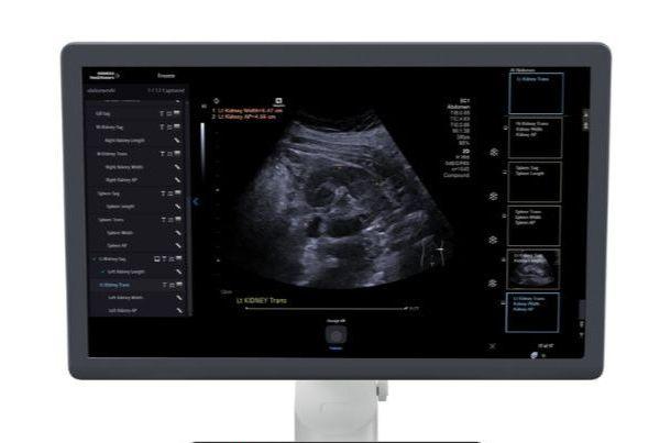 ACUSON Sequoia AI Abdomen 3.1