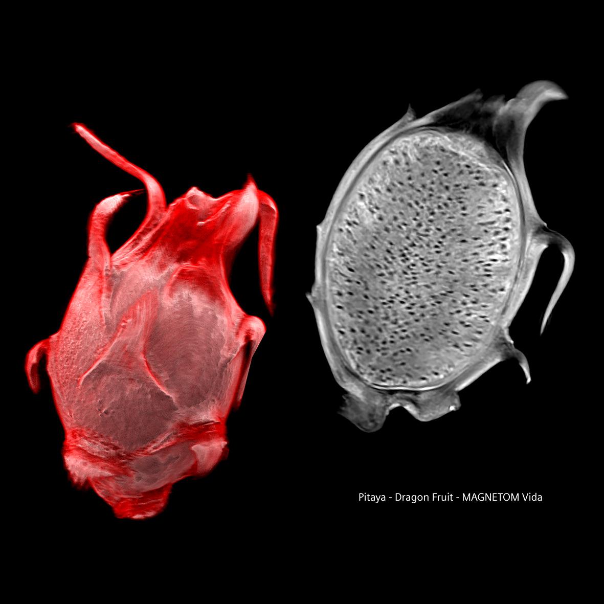 Siemens-healthineers_Magnetomworld_Dragon_Fruit_Vida