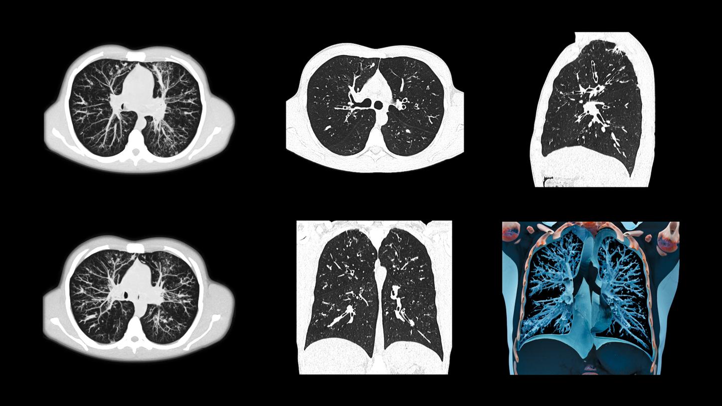 SOMATOM Edge Plus - Clinical Image