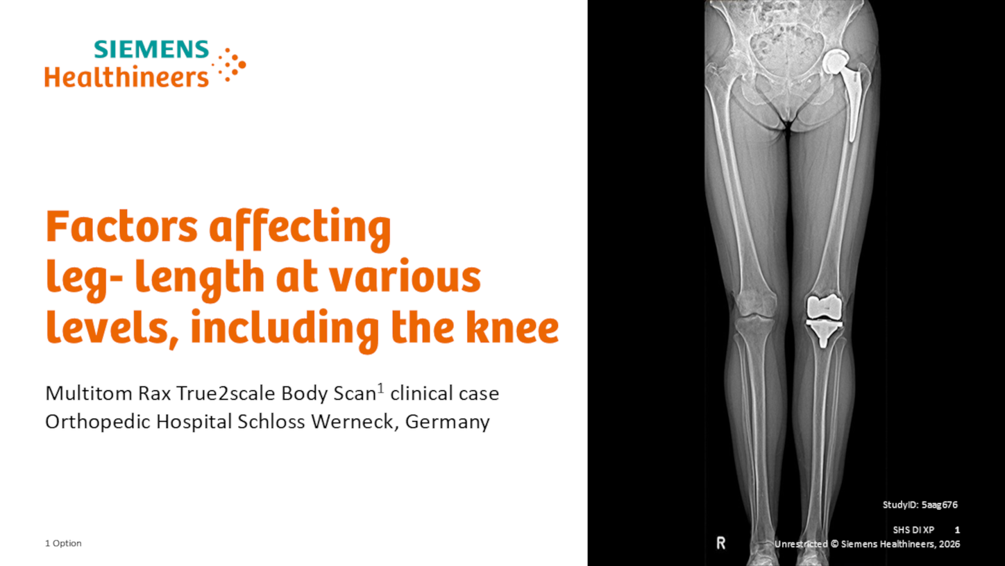 XP Multitom Rax Factors affecting leg