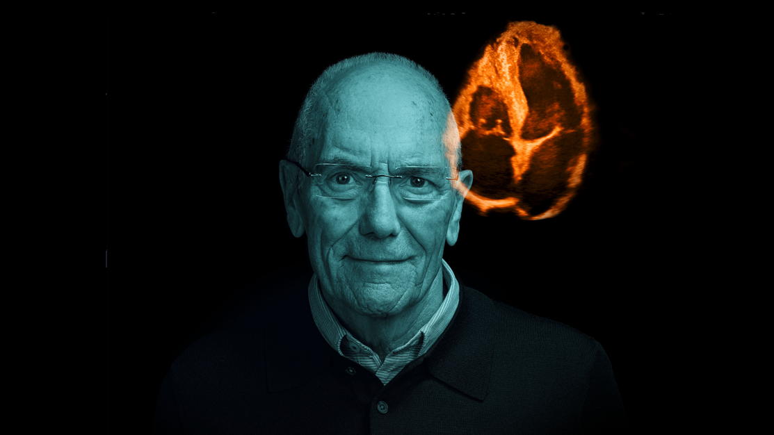 NNUH consulting case study key visual