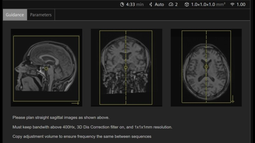 Siemens-healthineers_Magnetomworld_srs2