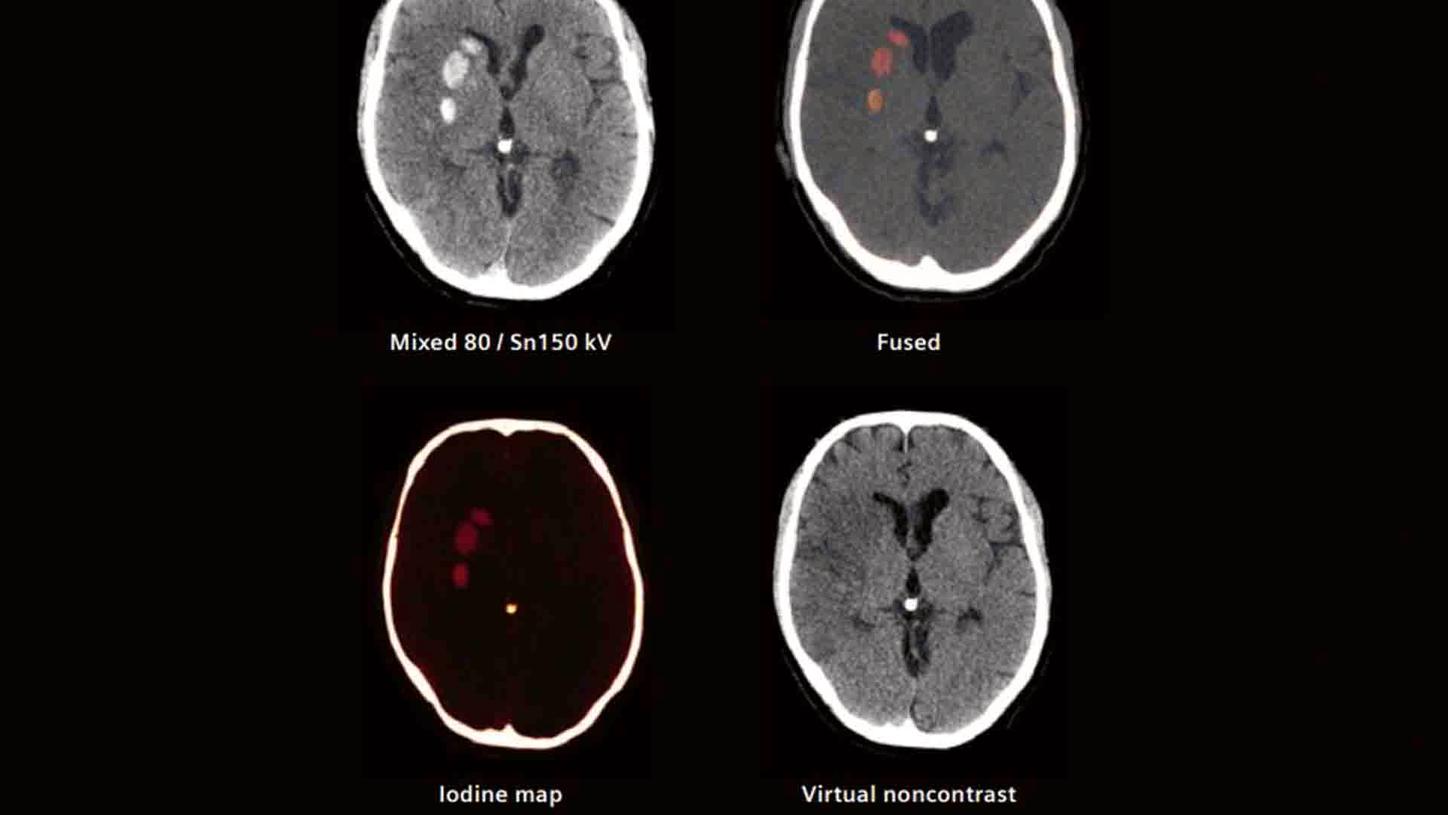 Dual Energy Technology Essentials