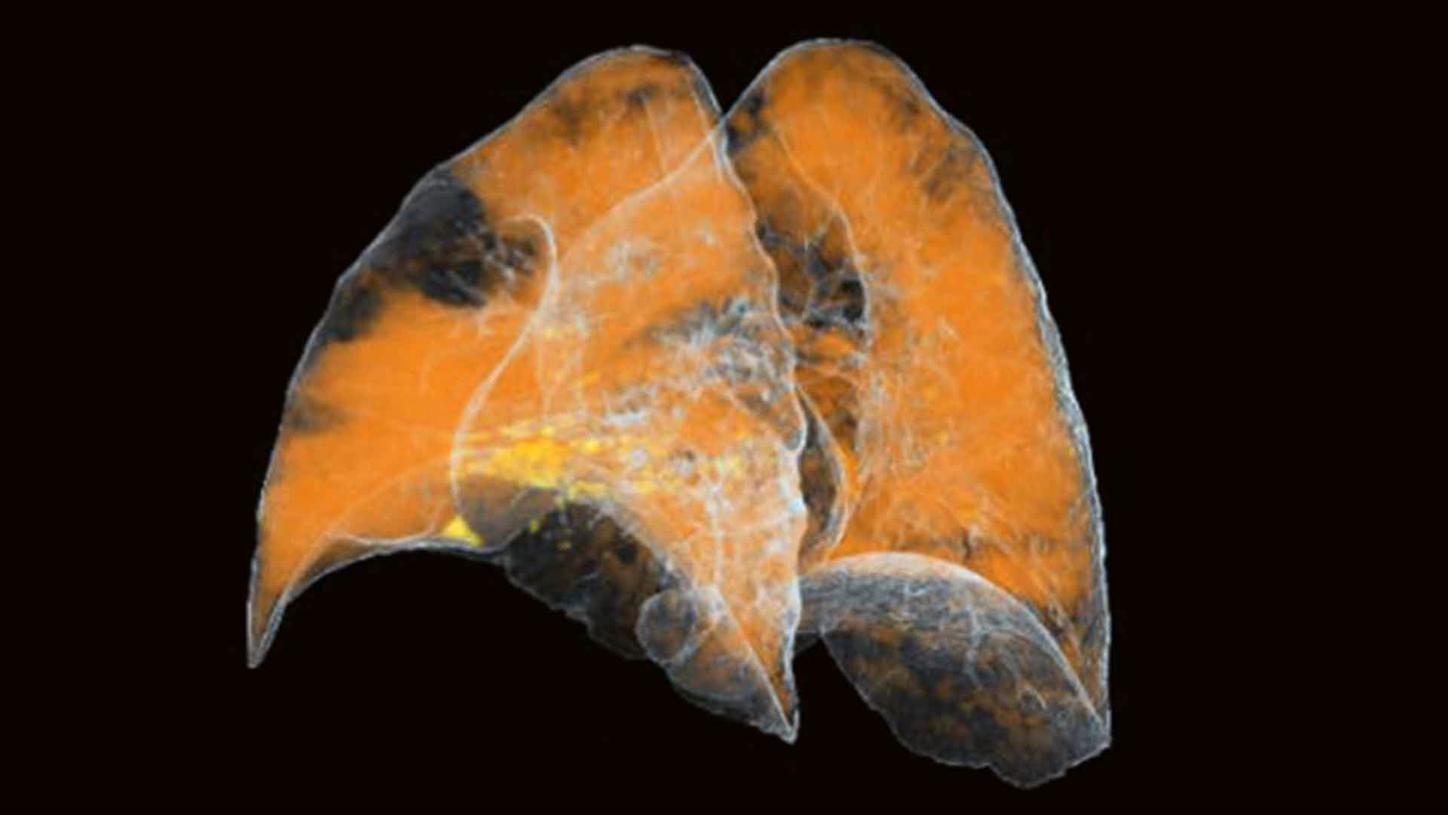 Dual Energy CT in Daily Practice