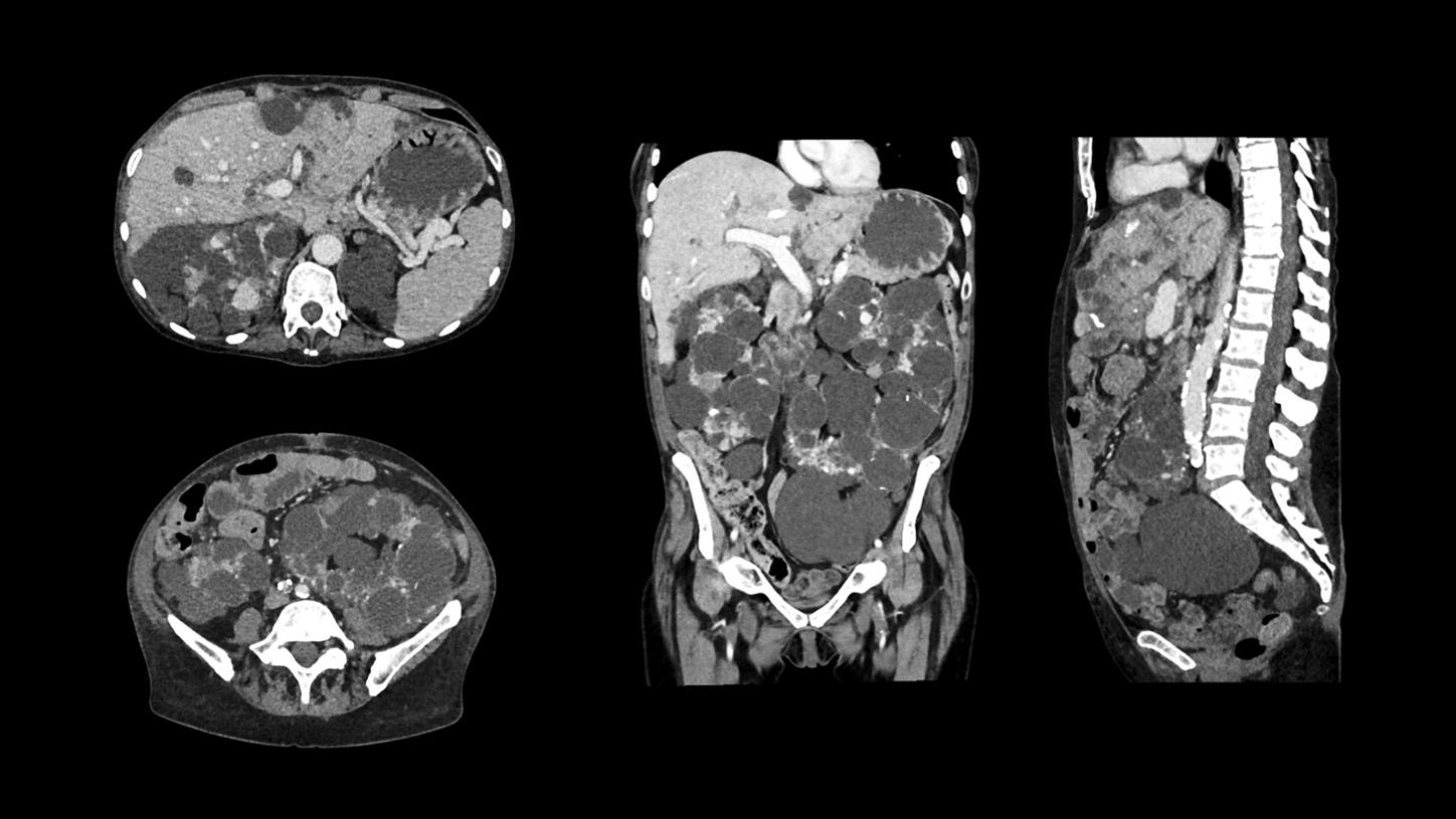 SOMATOM Edge Plus - Clinical Image