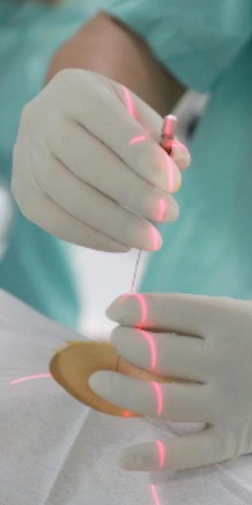 A clinician places a needle on a patient supported by myNeedle Laser indication of the skin entry point and needle path direction