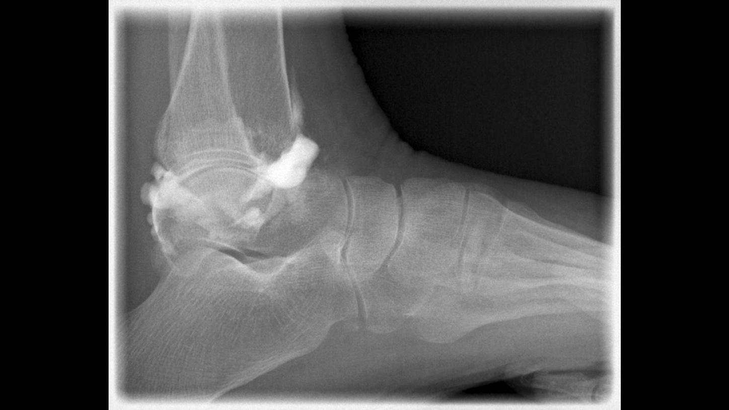 DI XP Luminos Qnamix ankle