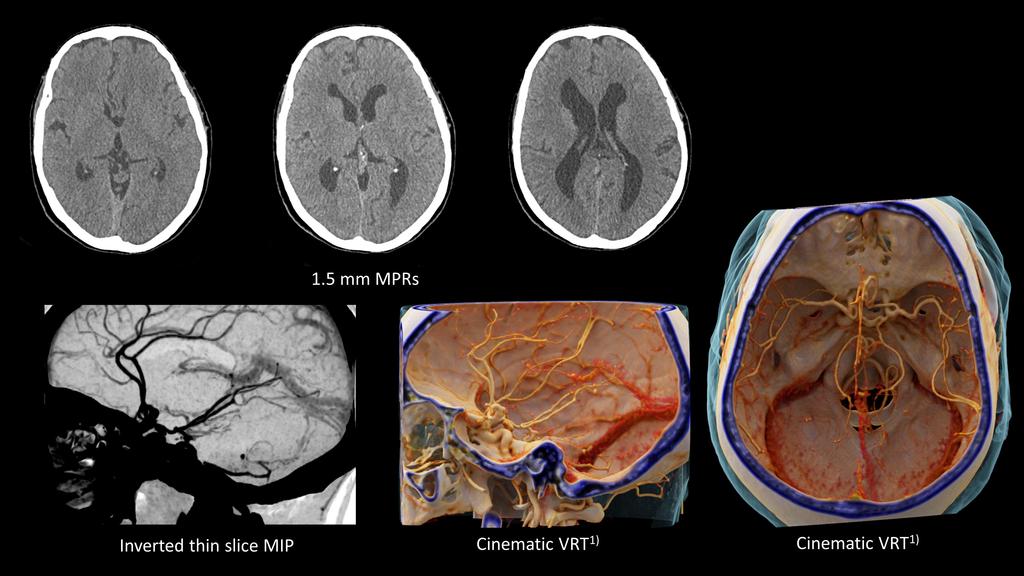 The SOMATOM go. platform – Made to match - Siemens Healthineers USA