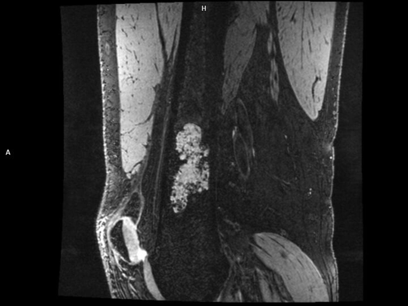 Sagittal T2 de3D we-MAGNETOM Terra