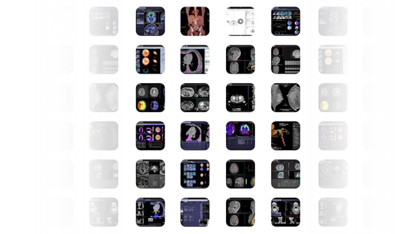 Explore Syngo Carbon Flexinity