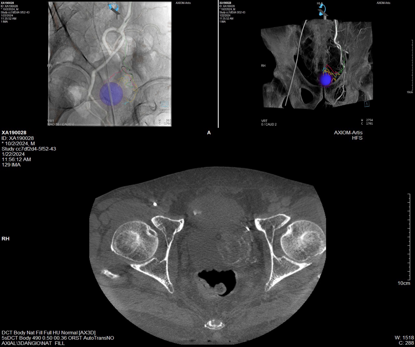 syngo DynaCT axial image