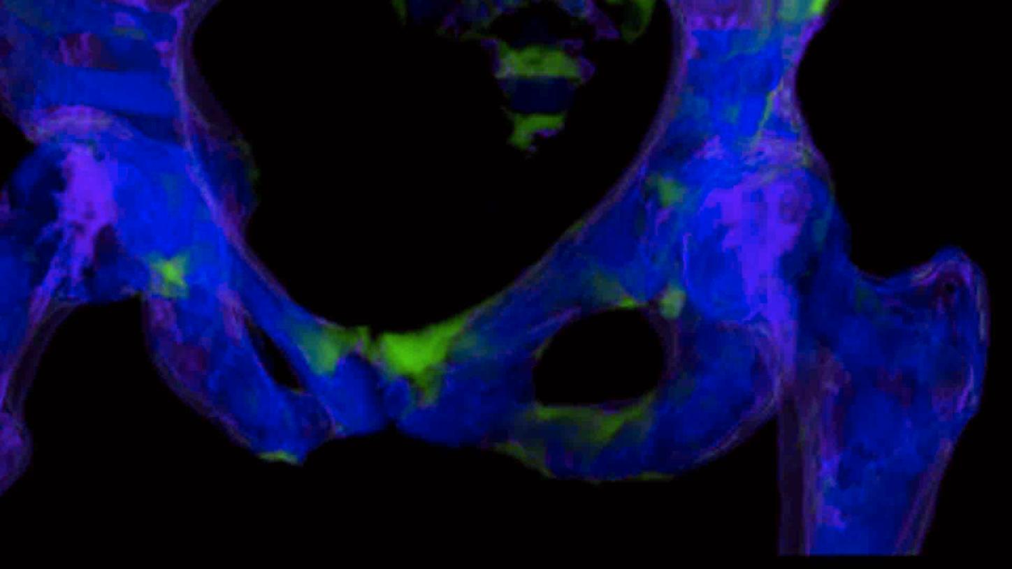 Dual EnergyCT Workshop with syngp.via