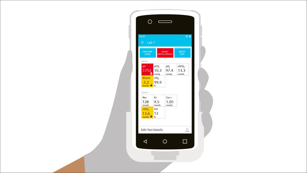 Optimierte durch wichtige Analysen direkt am PointofCare