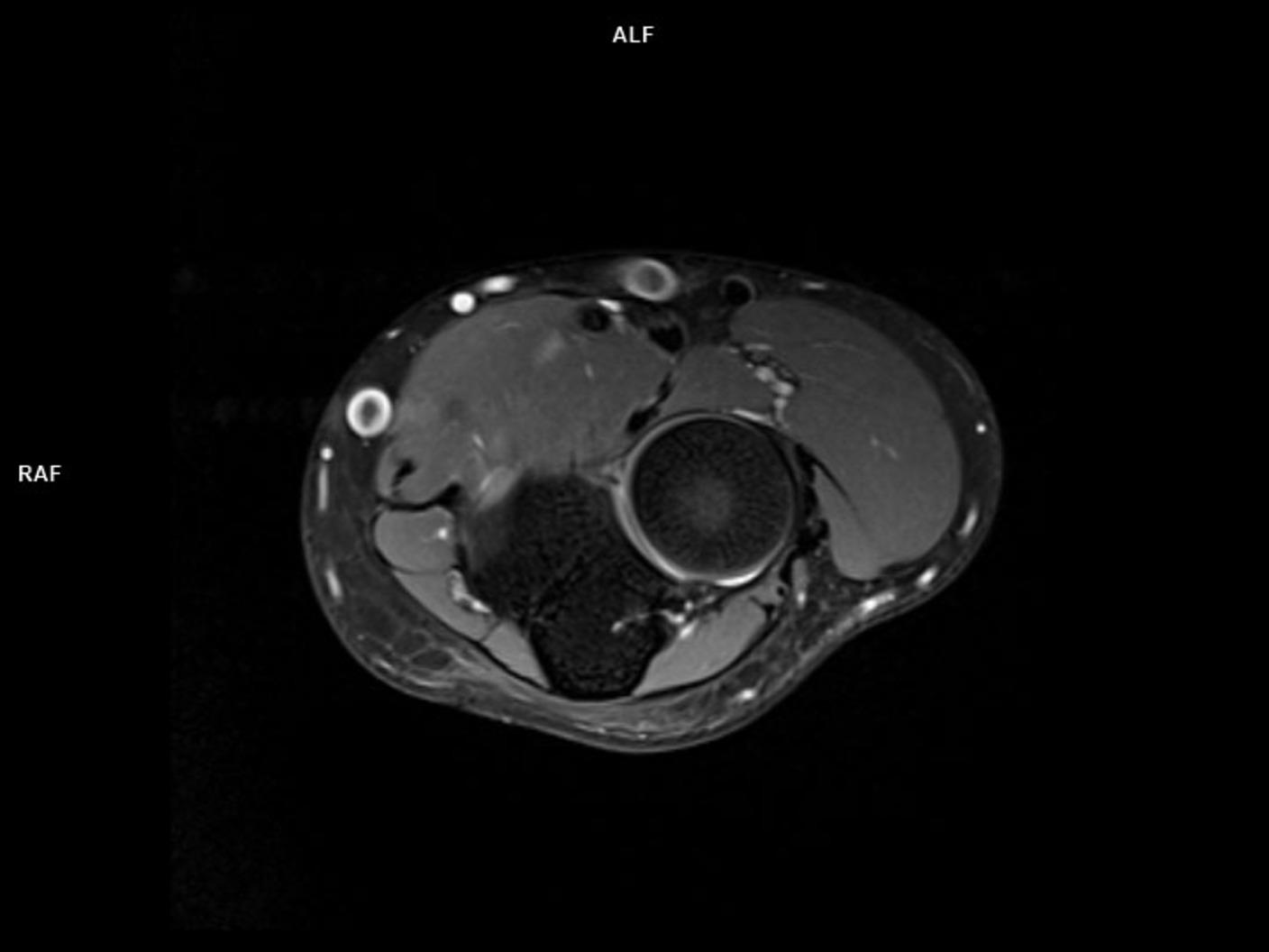 Axial PD FS-MAGNETOM Lumina<br />