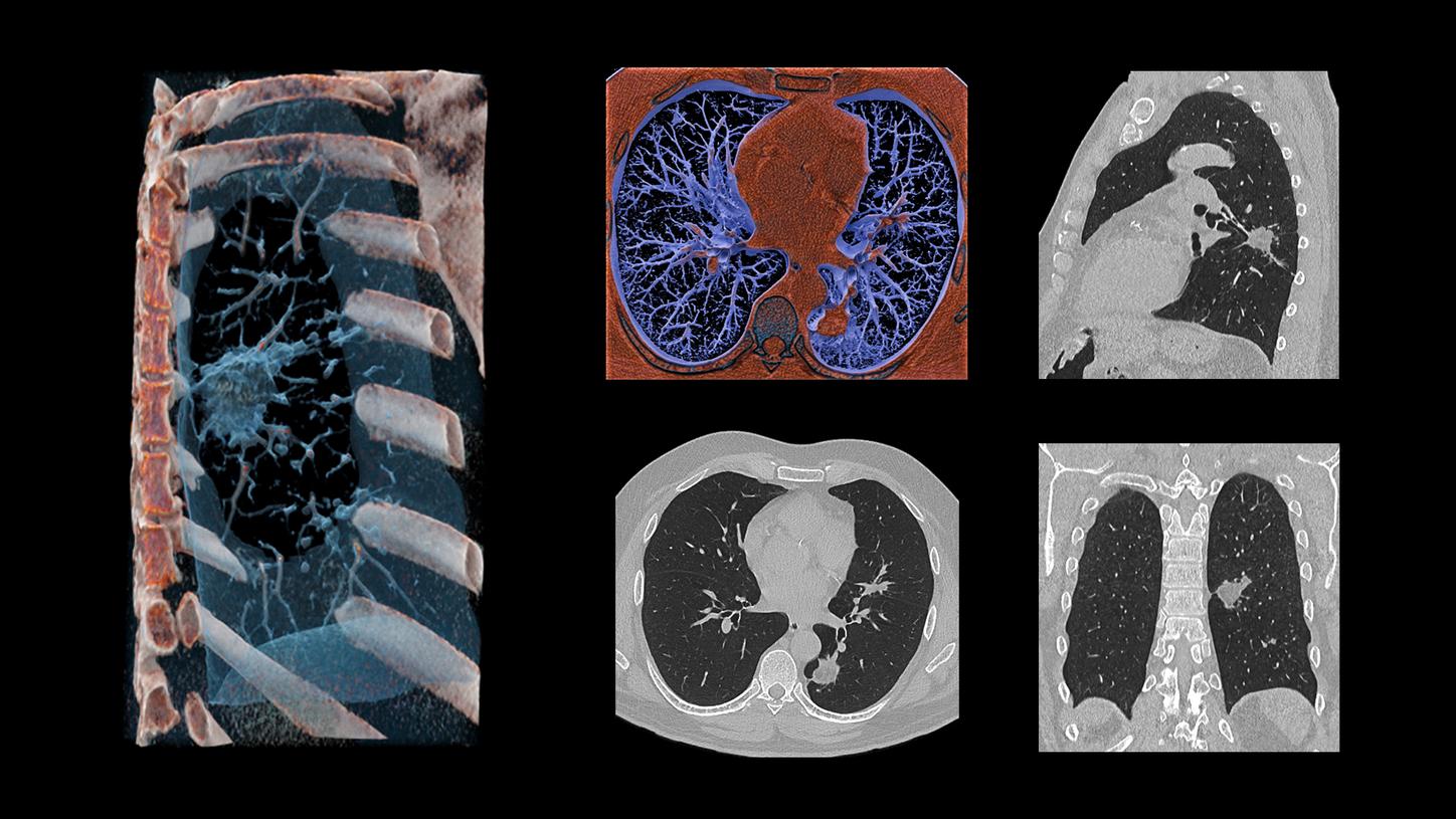 SOMATOM Edge Plus - Clinical Image