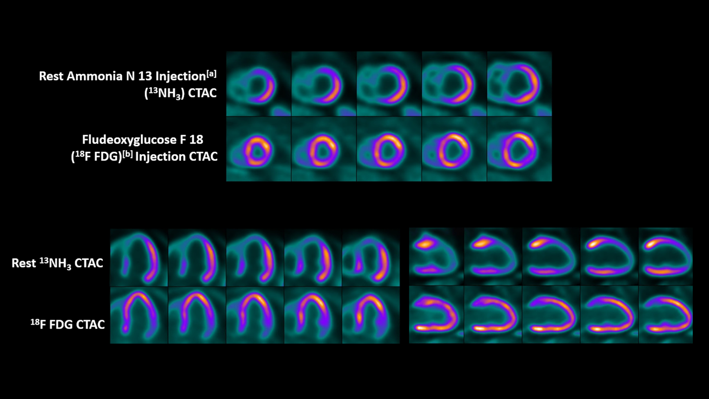 Clinical Images: Cardiology