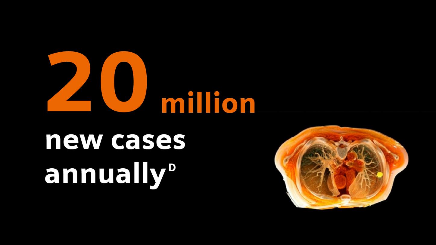 Infographic stating “20 million new cases annually” with a lung scan image.
