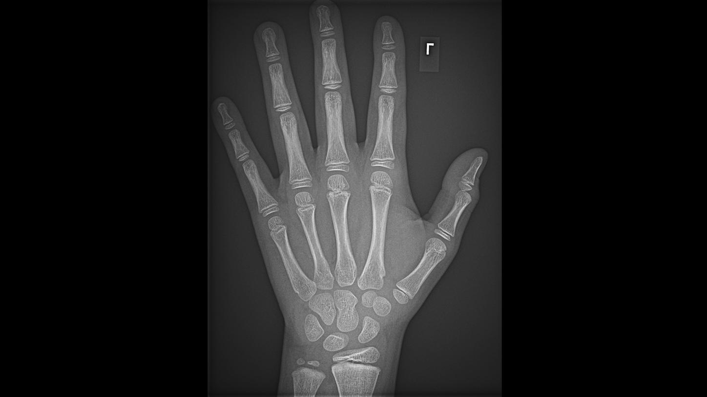 Floor X-ray machine MULTIX Impact E clinical image Orthopedic diagnostics